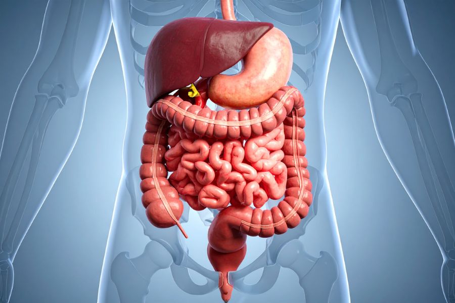 Εκκολπωματική παχέος εντέρου