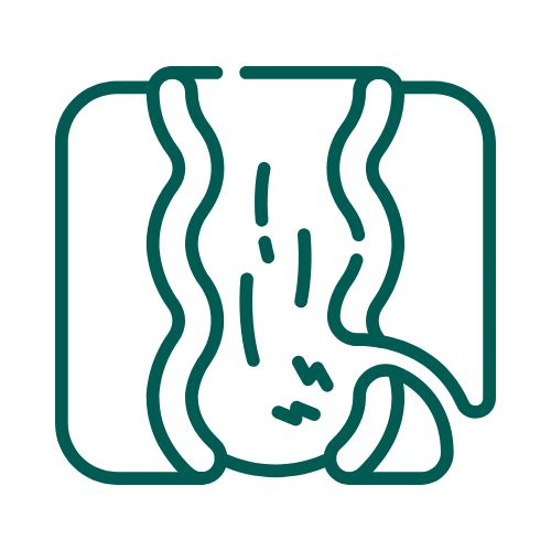 Περιπρωκτικό συρίγγιο